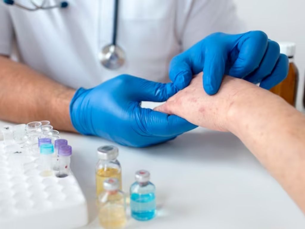 tipos de alergias exame