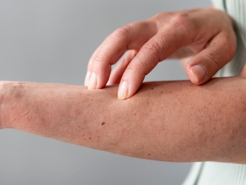 tipos de alergias pele