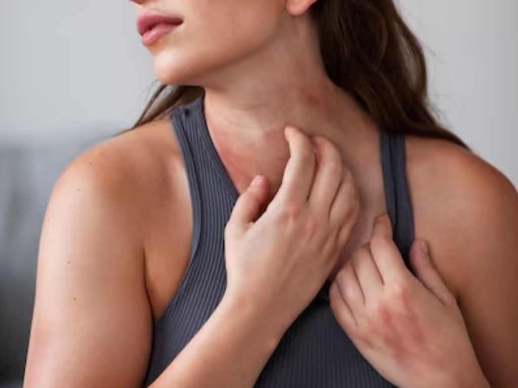 tipos de alergias urticária