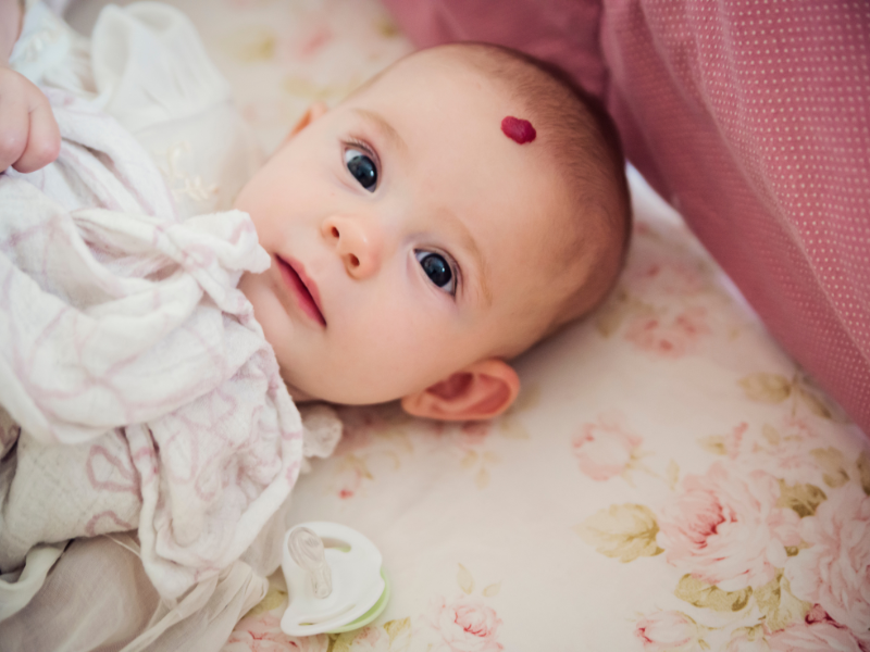 hemangioma infantil lesão