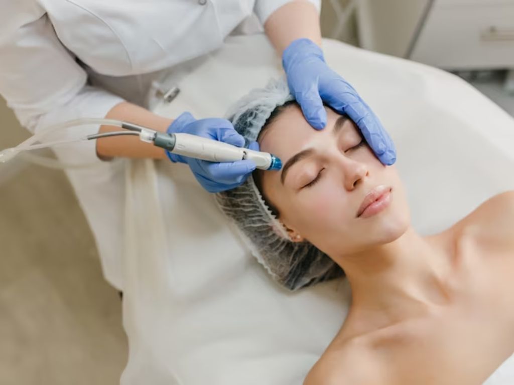tipos de manchas no rosto laser