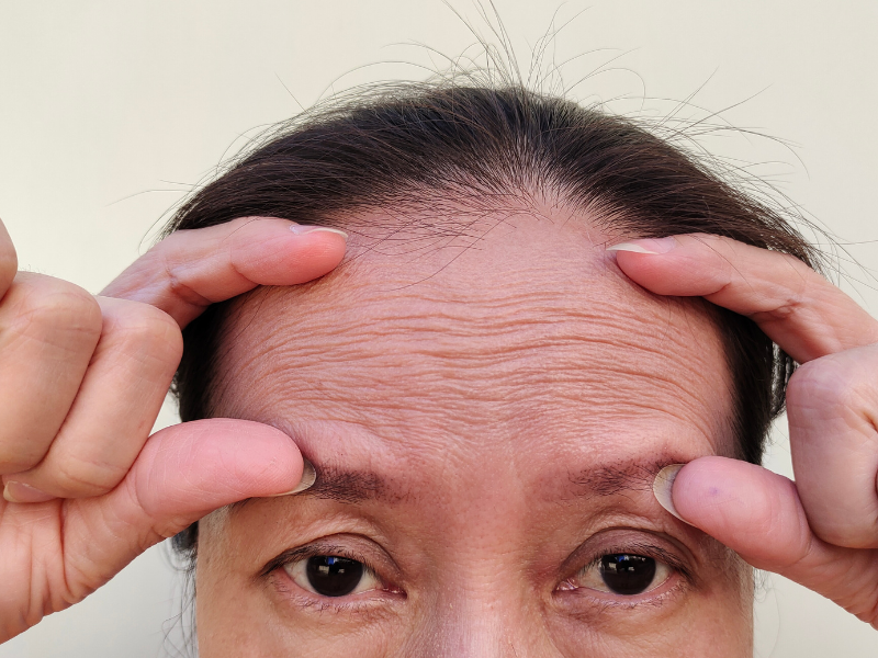 como melhorar a firmeza da pele do rosto o que causa