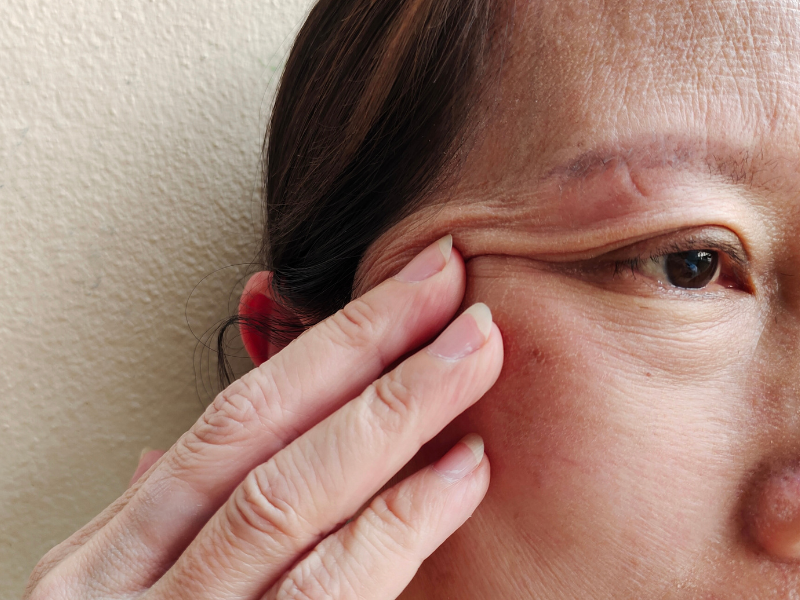 como melhorar a firmeza da pele do rosto