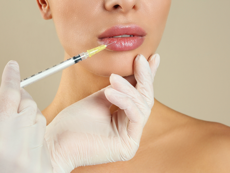 preenchimento facial boca